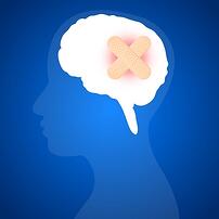 Migraine Surgery Migraine Surgery