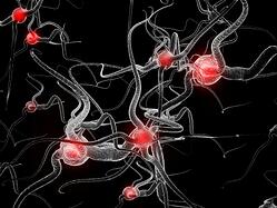 hemiplegic migraine hemiplegic migraine